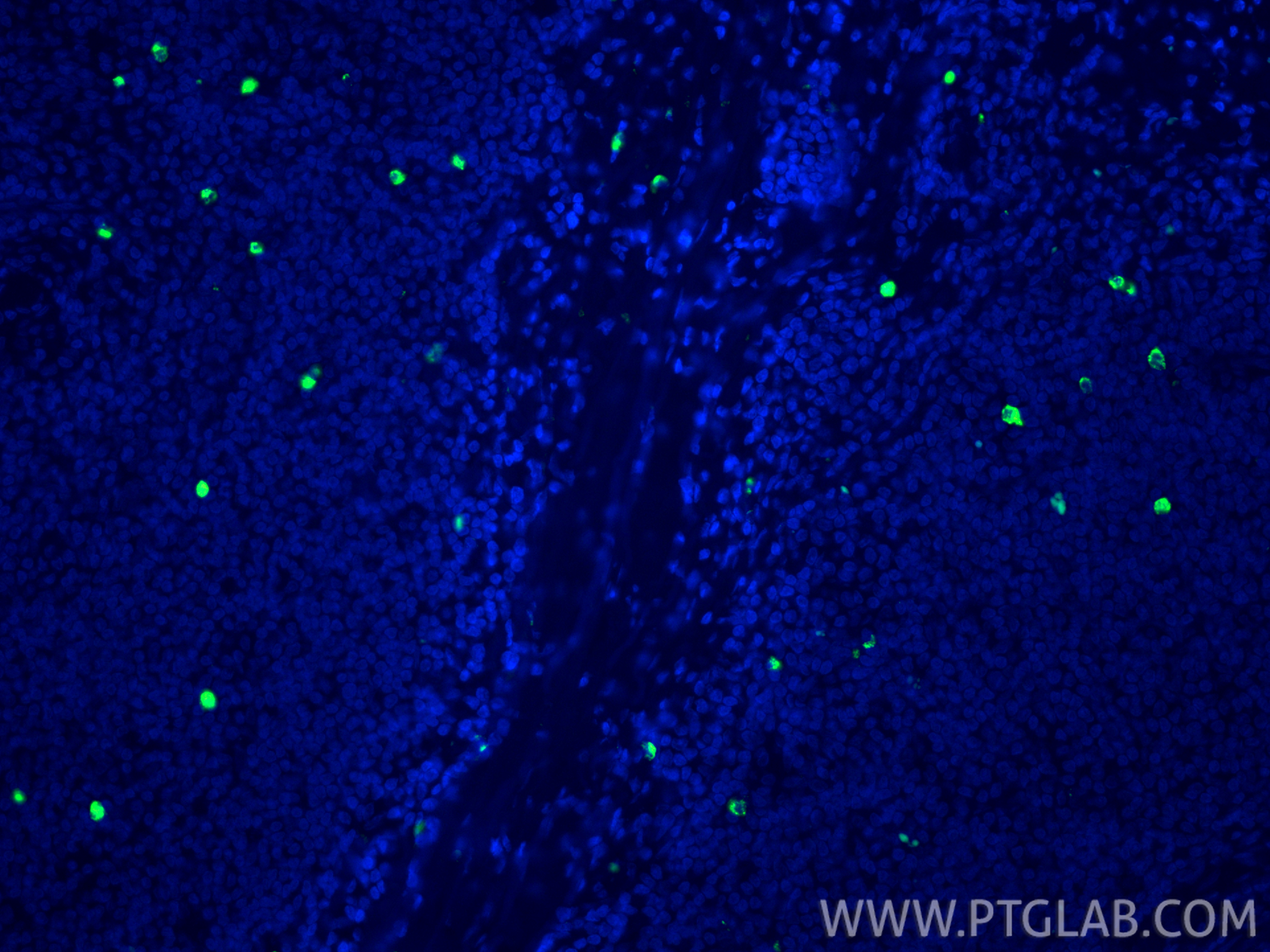Immunofluorescent analysis of (4% PFA) fixed paraffin-embedded human tonsillitis tissue using CoraLite® Plus 488 MPO antibody (CL488-81610, Clone: 3J17 ) at dilution of 1:200. Heat mediated antigen retrieval with Tris-EDTA buffer (pH 9.0). IF Staining of human tonsillitis using CL488-81610