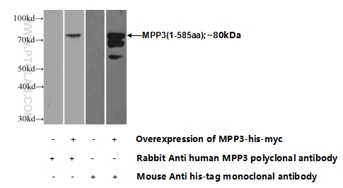 MPP3