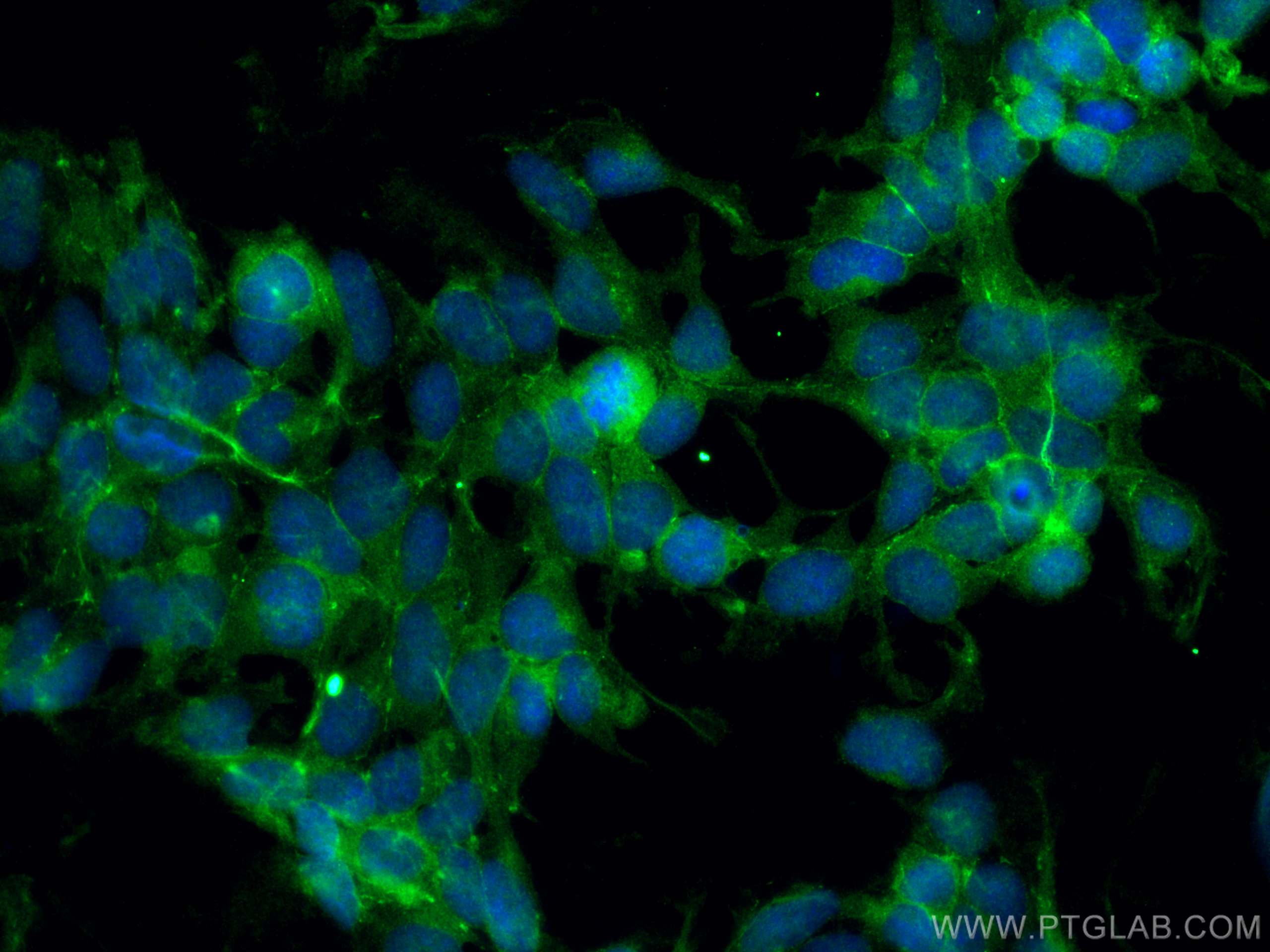IF Staining of HEK-293 using 17710-1-AP