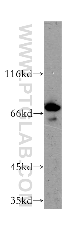 MPP5 Polyclonal antibody