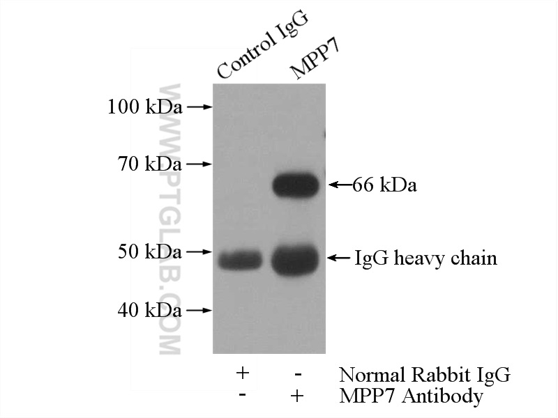 IP experiment of HeLa using 12983-1-AP