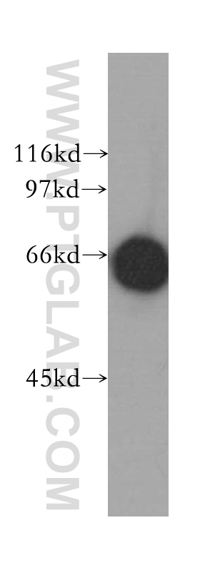 WB analysis of HeLa using 12983-1-AP