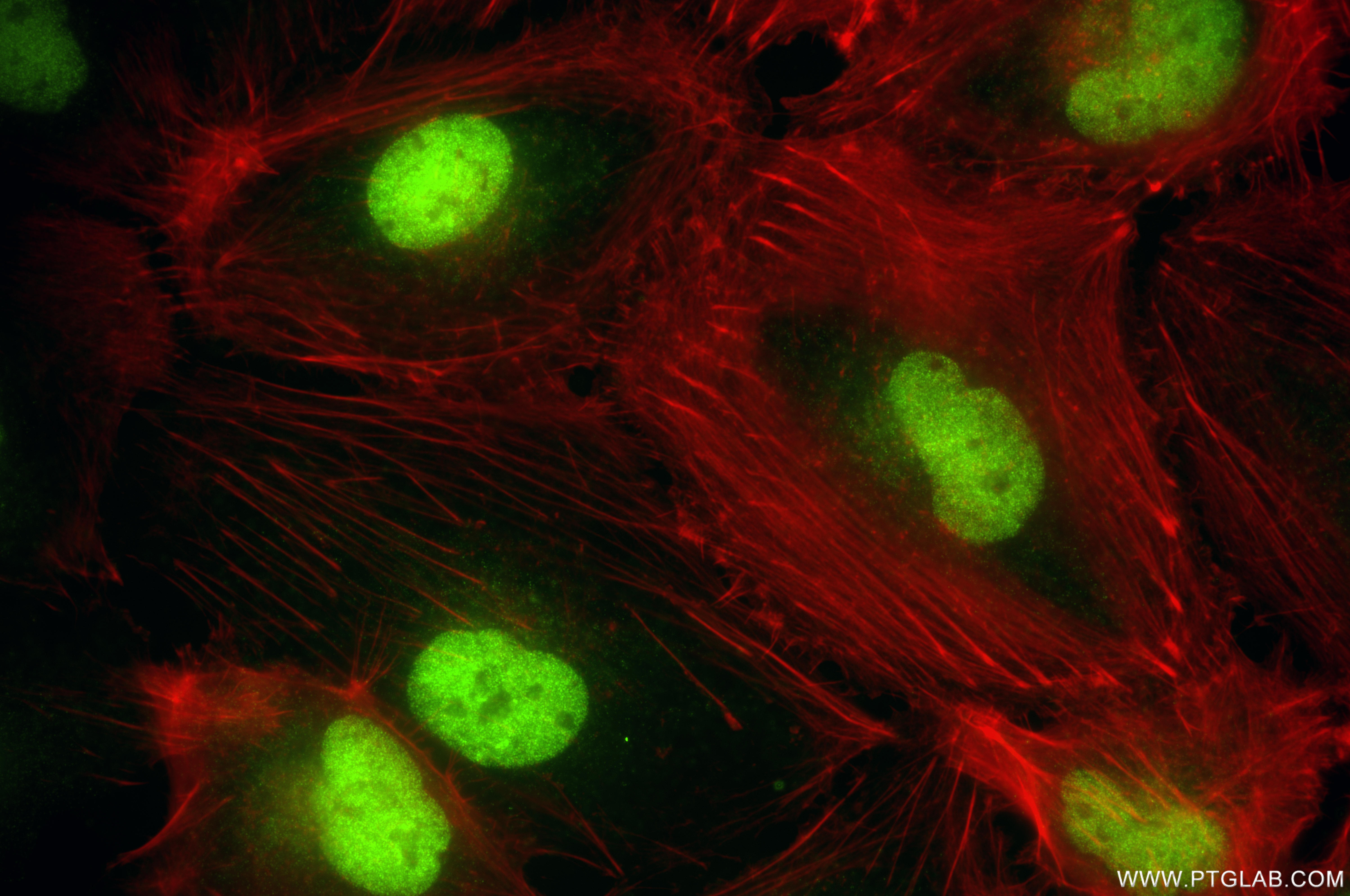 IF Staining of U-251 using 84719-4-RR (same clone as 84719-4-PBS)
