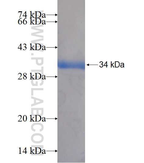 MPPE1 fusion protein Ag7652 SDS-PAGE