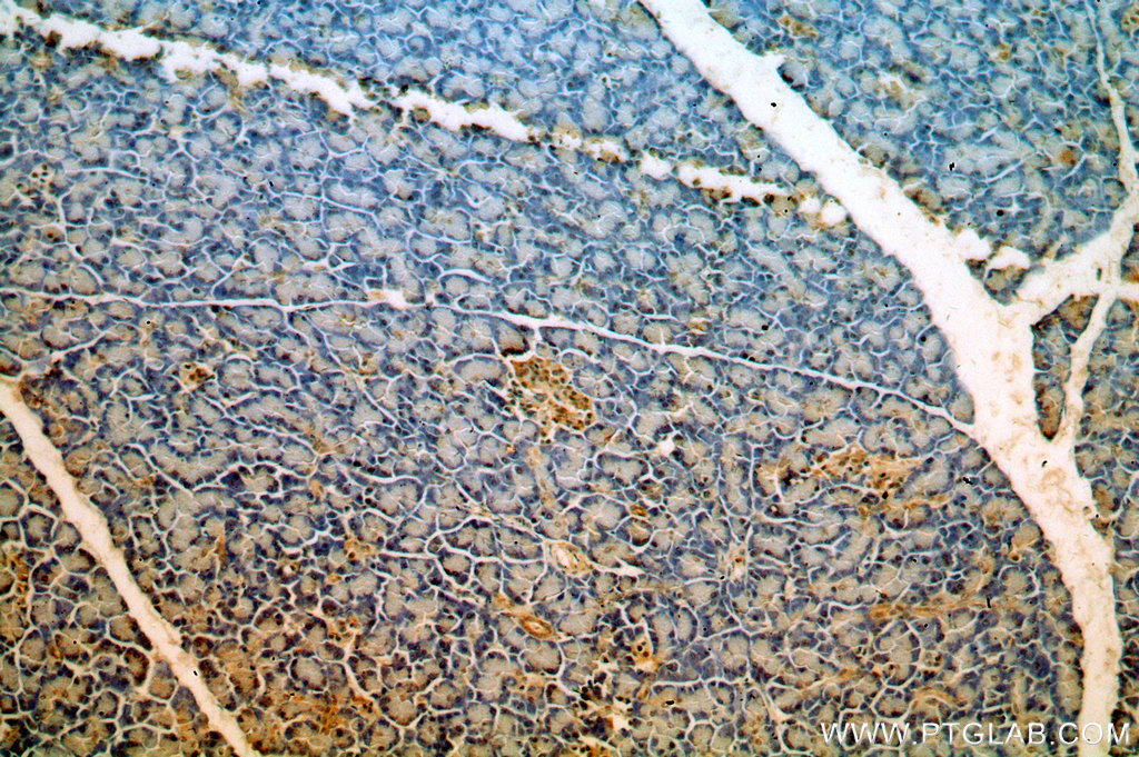 IHC staining of human pancreas using 13677-1-AP