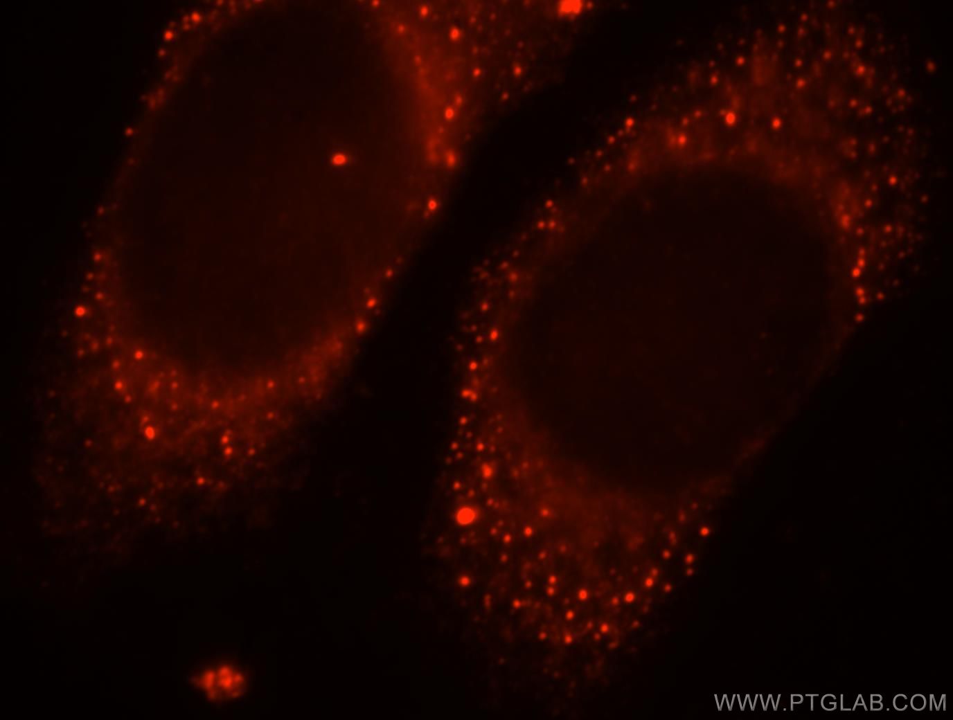 IF Staining of HepG2 using 13270-1-AP