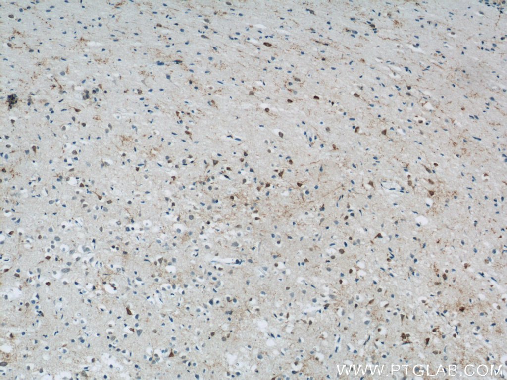 IHC staining of human brain using 13270-1-AP