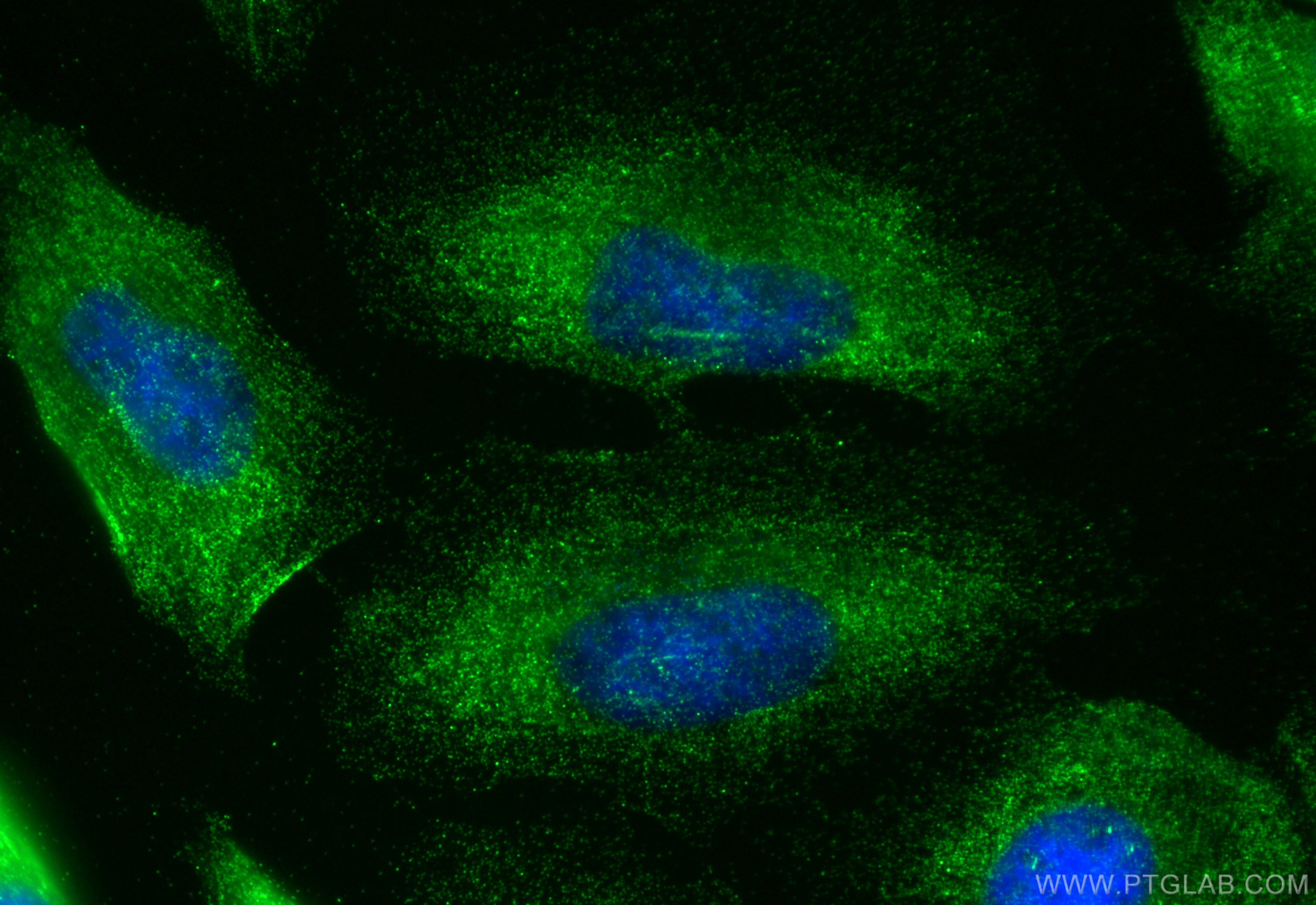 IF Staining of HeLa using 20040-1-AP