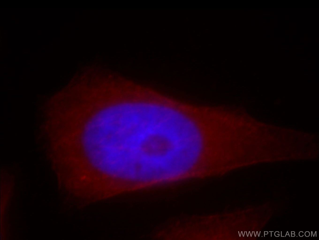 IF Staining of HeLa using 20040-1-AP