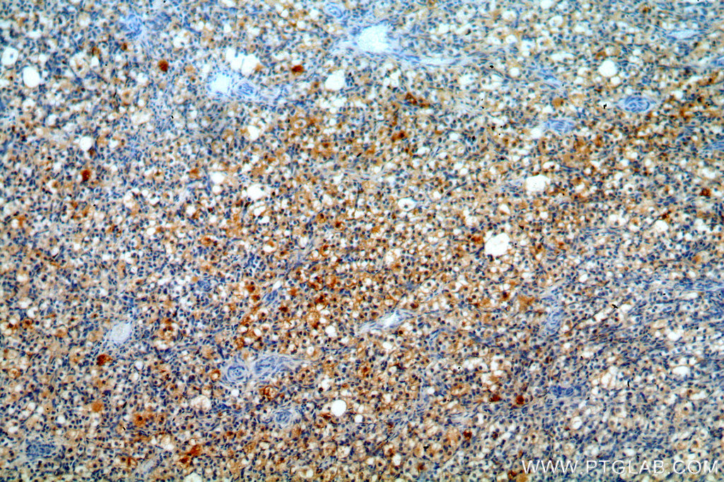 IHC staining of human ovary using 20040-1-AP