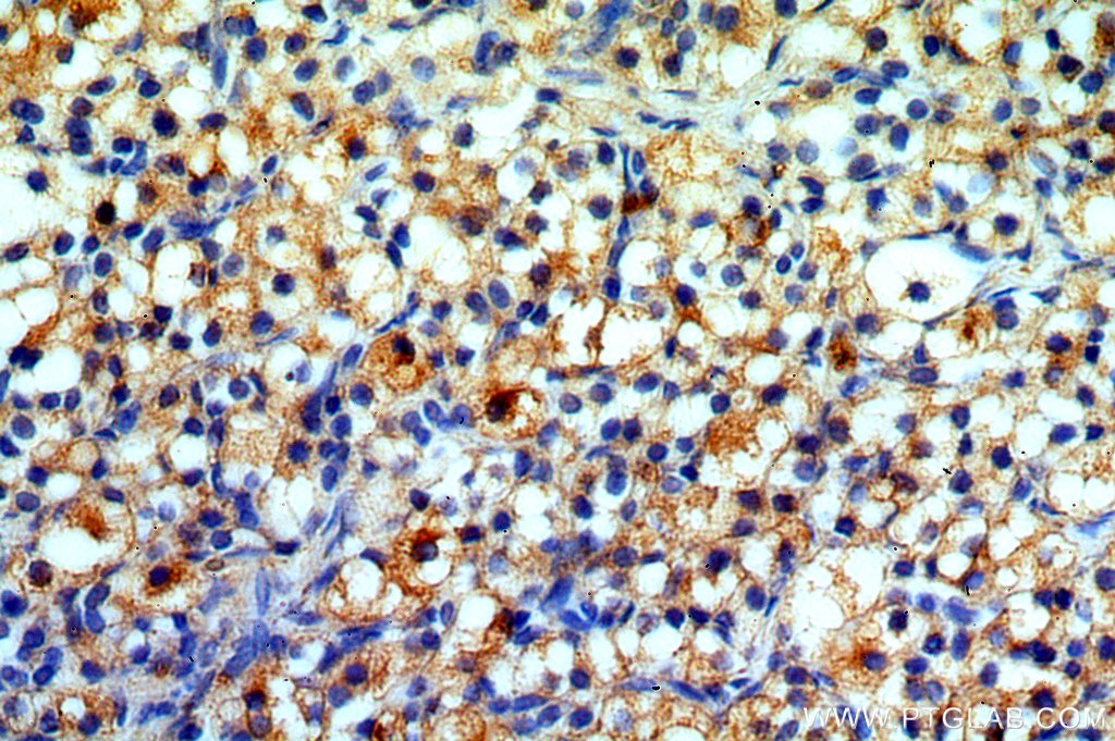 IHC staining of human ovary using 20040-1-AP