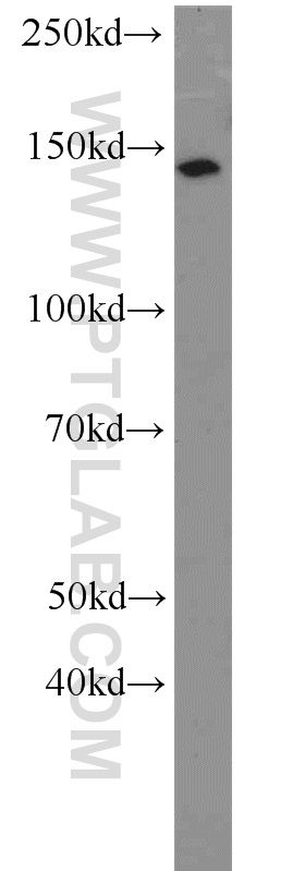 WB analysis of SH-SY5Y using 20040-1-AP