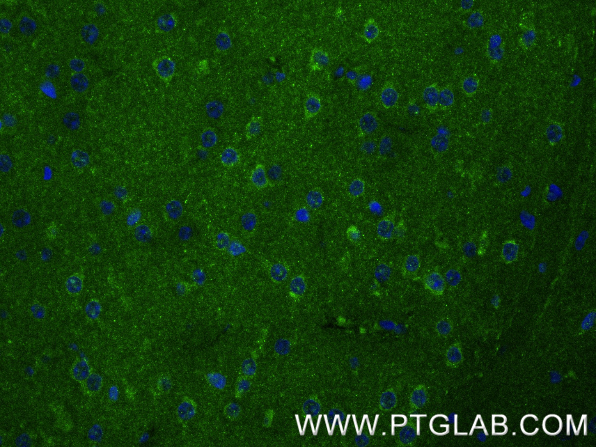 Immunofluorescent analysis of (4% PFA) fixed paraffin-embedded mouse brain tissue using MPRIP antibody (86033-1-RR, Clone: 250643B2 ) at dilution of 1:400 and CoraLite®488-Conjugated Goat Anti-Rabbit IgG(H+L) (<a class='green' href='/productredirect?CatalogNo=SA00013-2' target='_blank'>SA00013-2</a>). Heat mediated antigen retrieval with Tris-EDTA buffer (pH 9.0). IF Staining of mouse brain using 86033-1-RR