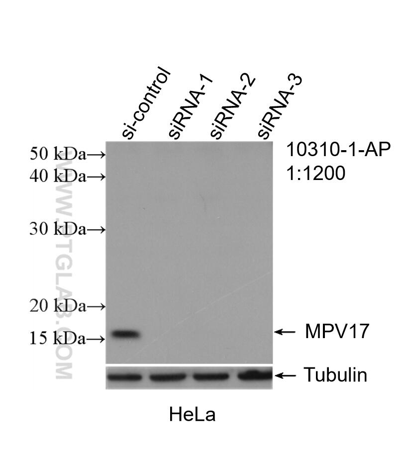 WB analysis of HeLa using 10310-1-AP