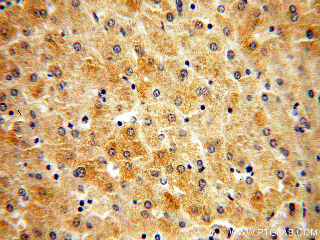 IHC staining of human liver using 60103-1-Ig