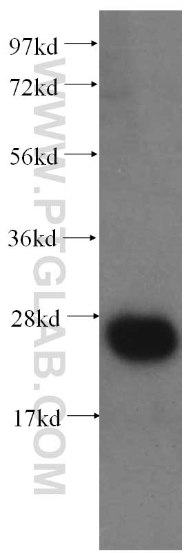 WB analysis of human heart using 60103-1-Ig