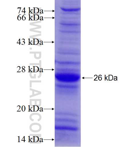 MPV17 fusion protein Ag8083 SDS-PAGE