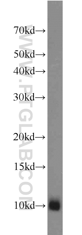 WB analysis of mouse kidney using 17884-1-AP