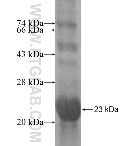 MPV17L fusion protein Ag11935 SDS-PAGE