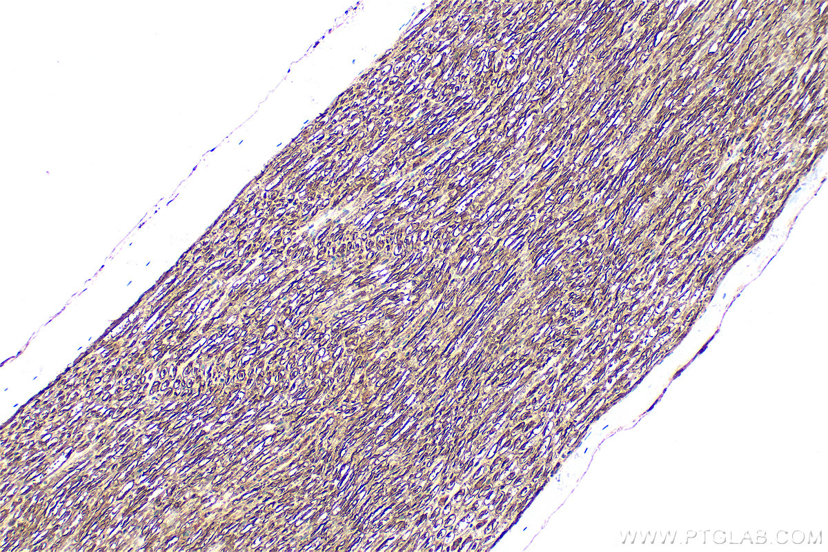 IHC staining of rat Ischiadic nerve using 10572-1-AP (same clone as 10572-1-PBS) IHC staining of rat Ischiadic nerve using 10572-1-AP (same clone as 10572-1-PBS)