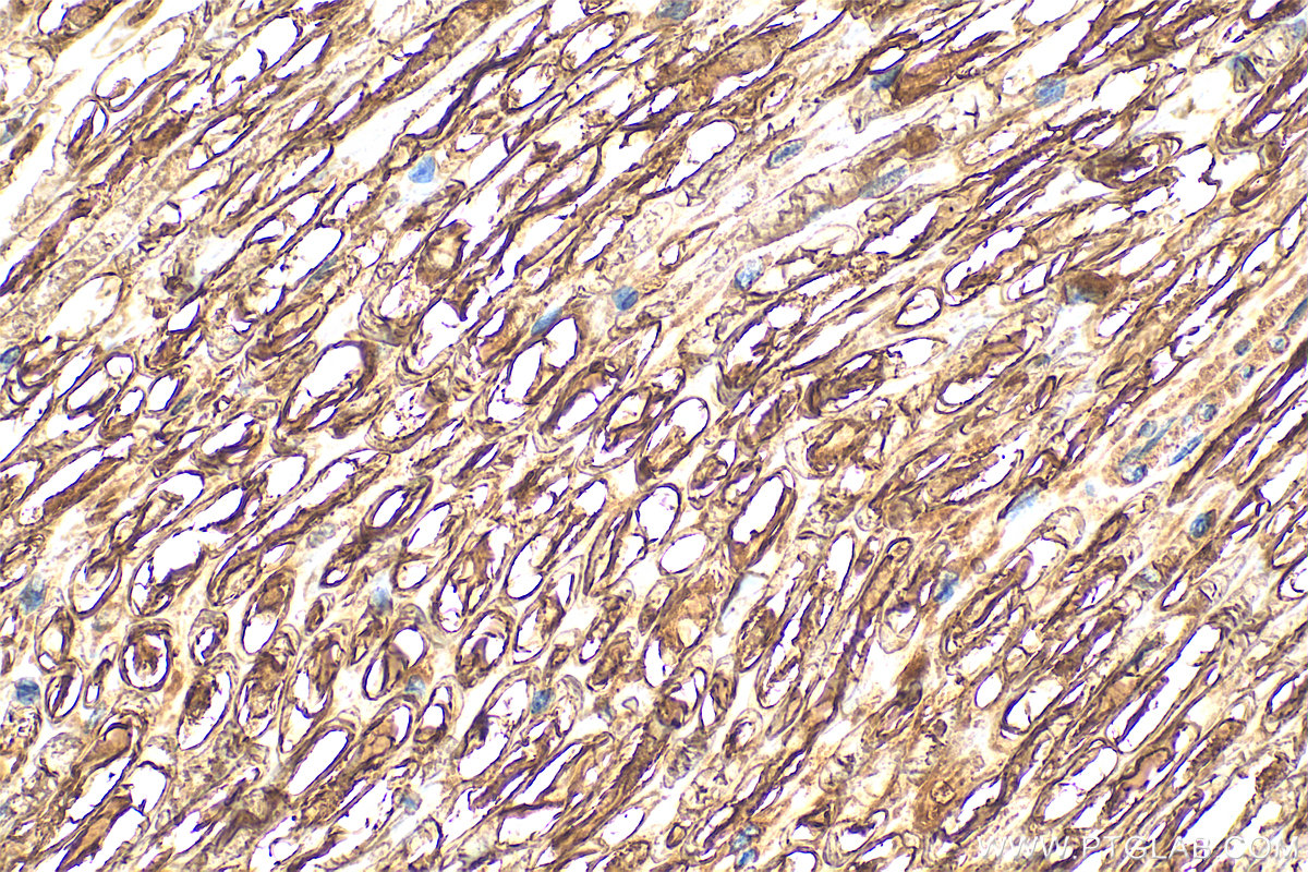 IHC staining of rat Ischiadic nerve using 10572-1-AP (same clone as 10572-1-PBS) IHC staining of rat Ischiadic nerve using 10572-1-AP (same clone as 10572-1-PBS)