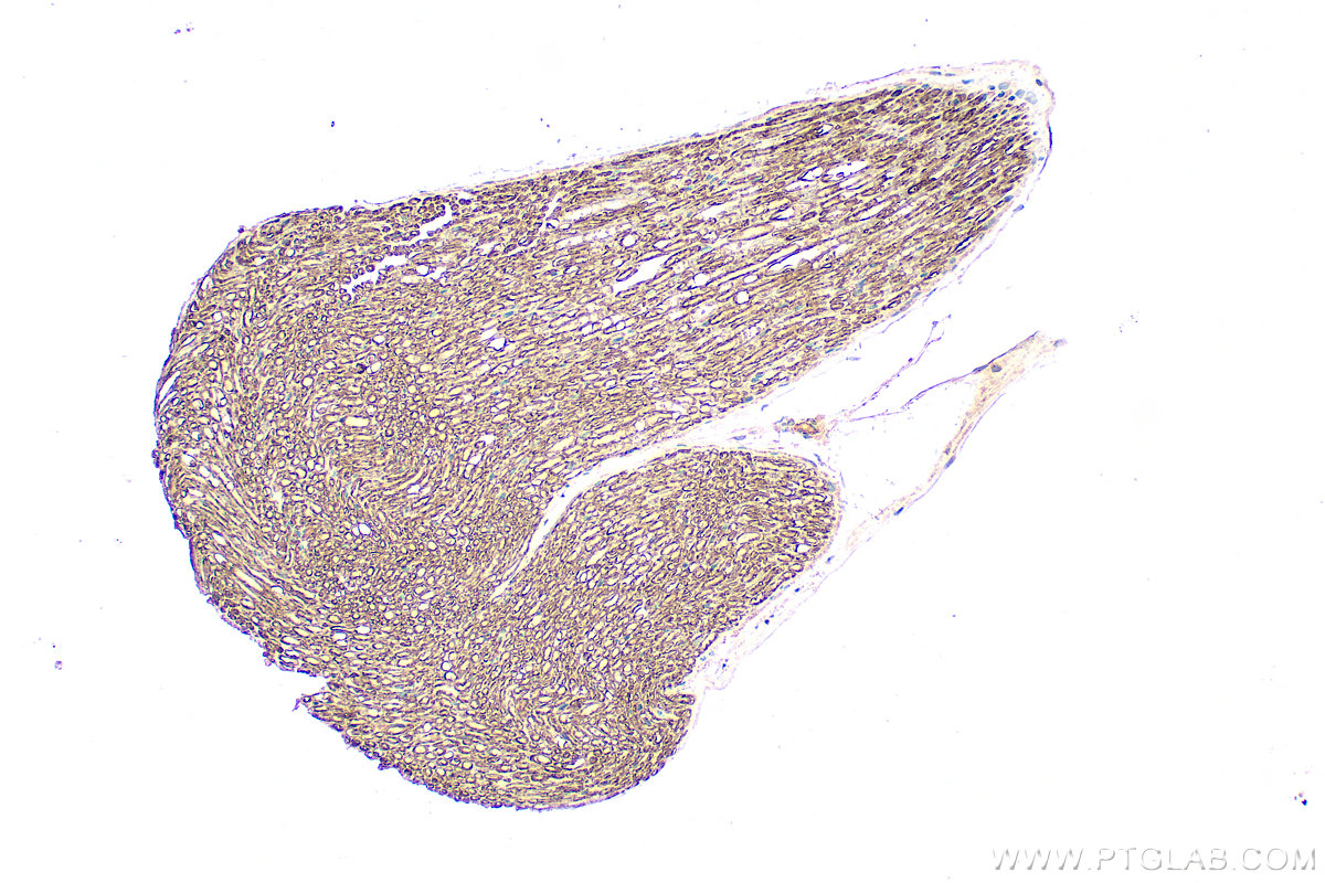IHC staining of mouse Ischiadic nerve using 10572-1-AP (same clone as 10572-1-PBS) IHC staining of mouse Ischiadic nerve using 10572-1-AP (same clone as 10572-1-PBS)