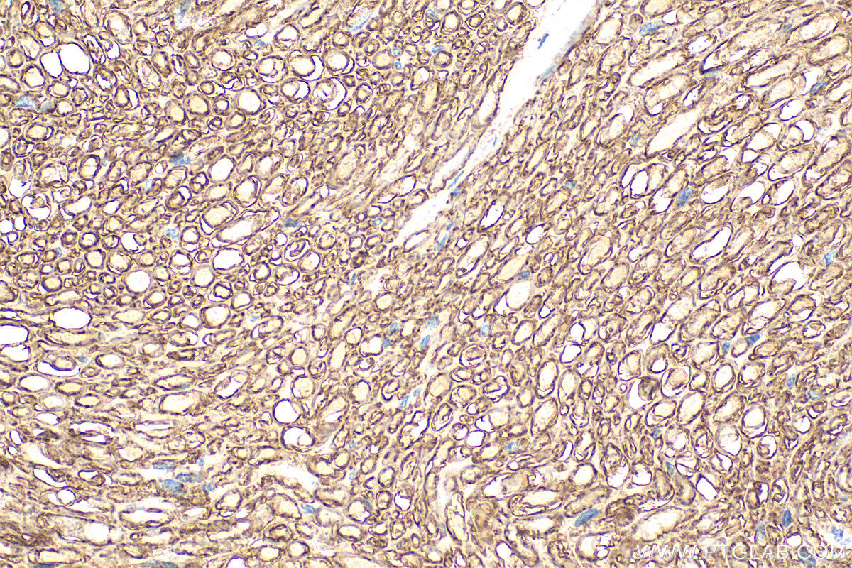 IHC staining of mouse Ischiadic nerve using 10572-1-AP (same clone as 10572-1-PBS) IHC staining of mouse Ischiadic nerve using 10572-1-AP (same clone as 10572-1-PBS)