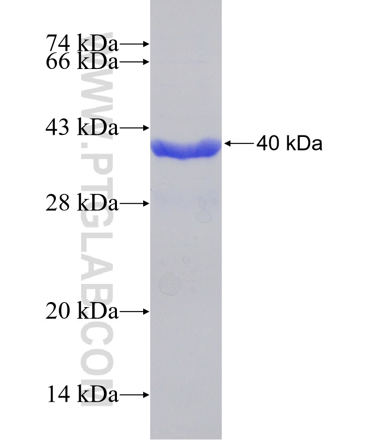 MPZL1 fusion protein Ag31532 SDS-PAGE