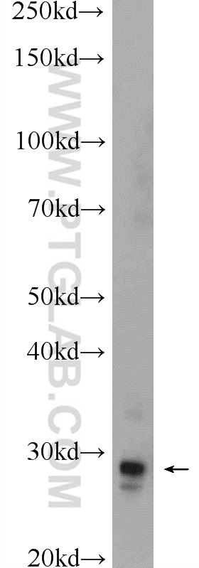 WB analysis of mouse brain using 25513-1-AP