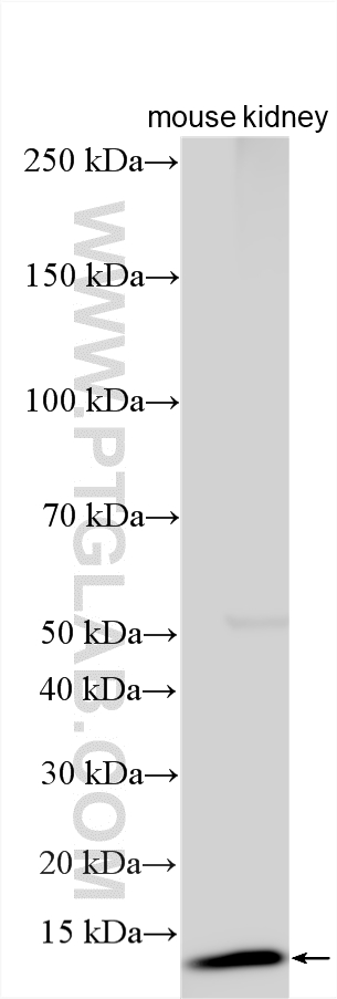 WB analysis using 19512-1-AP WB analysis using 19512-1-AP
