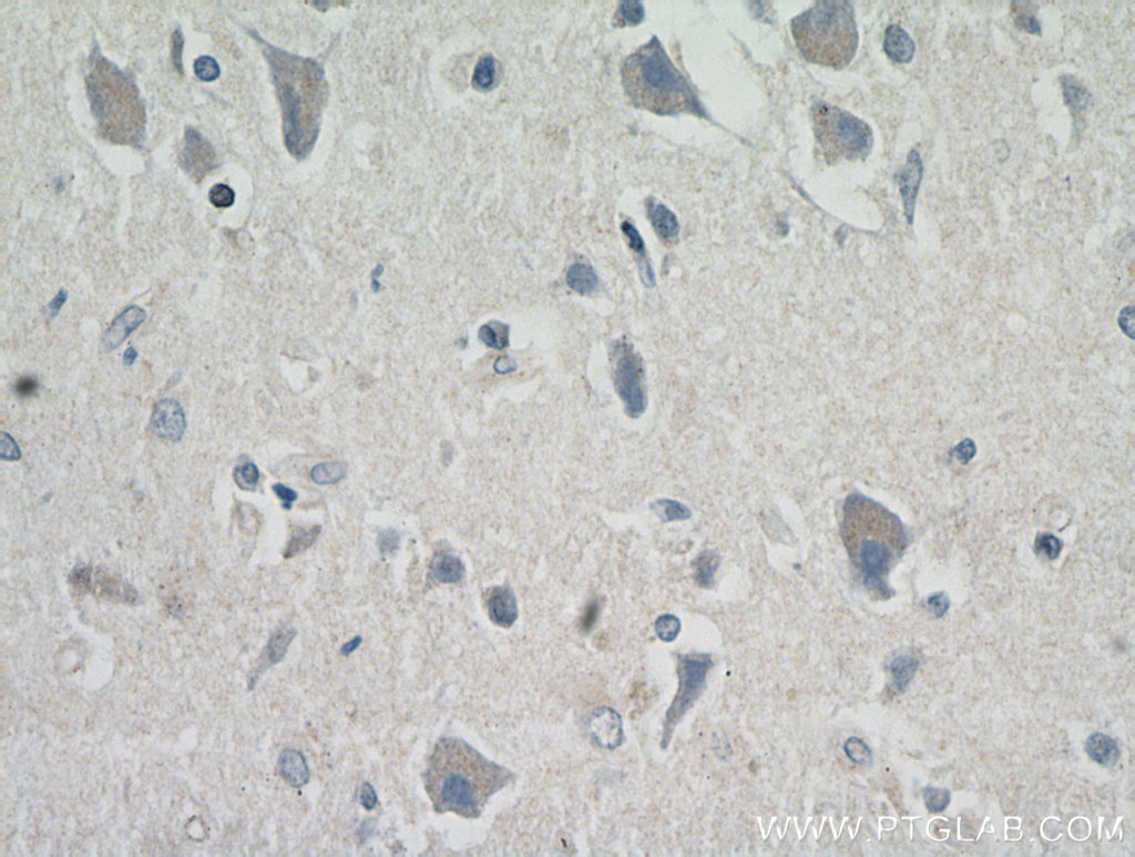 IHC staining of human brain using 17259-1-AP