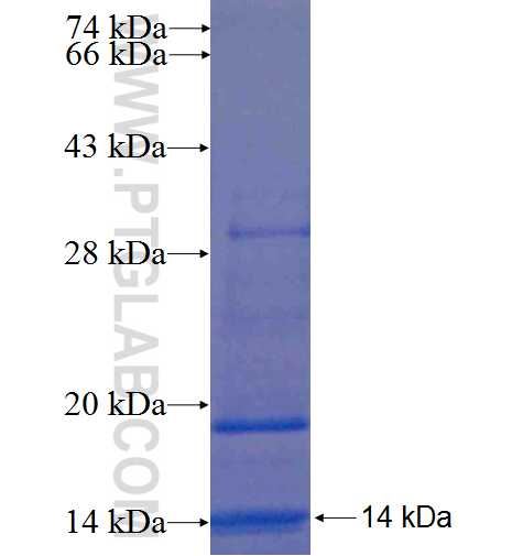 MRAS fusion protein Ag6262 SDS-PAGE MRAS fusion protein Ag6262 SDS-PAGE