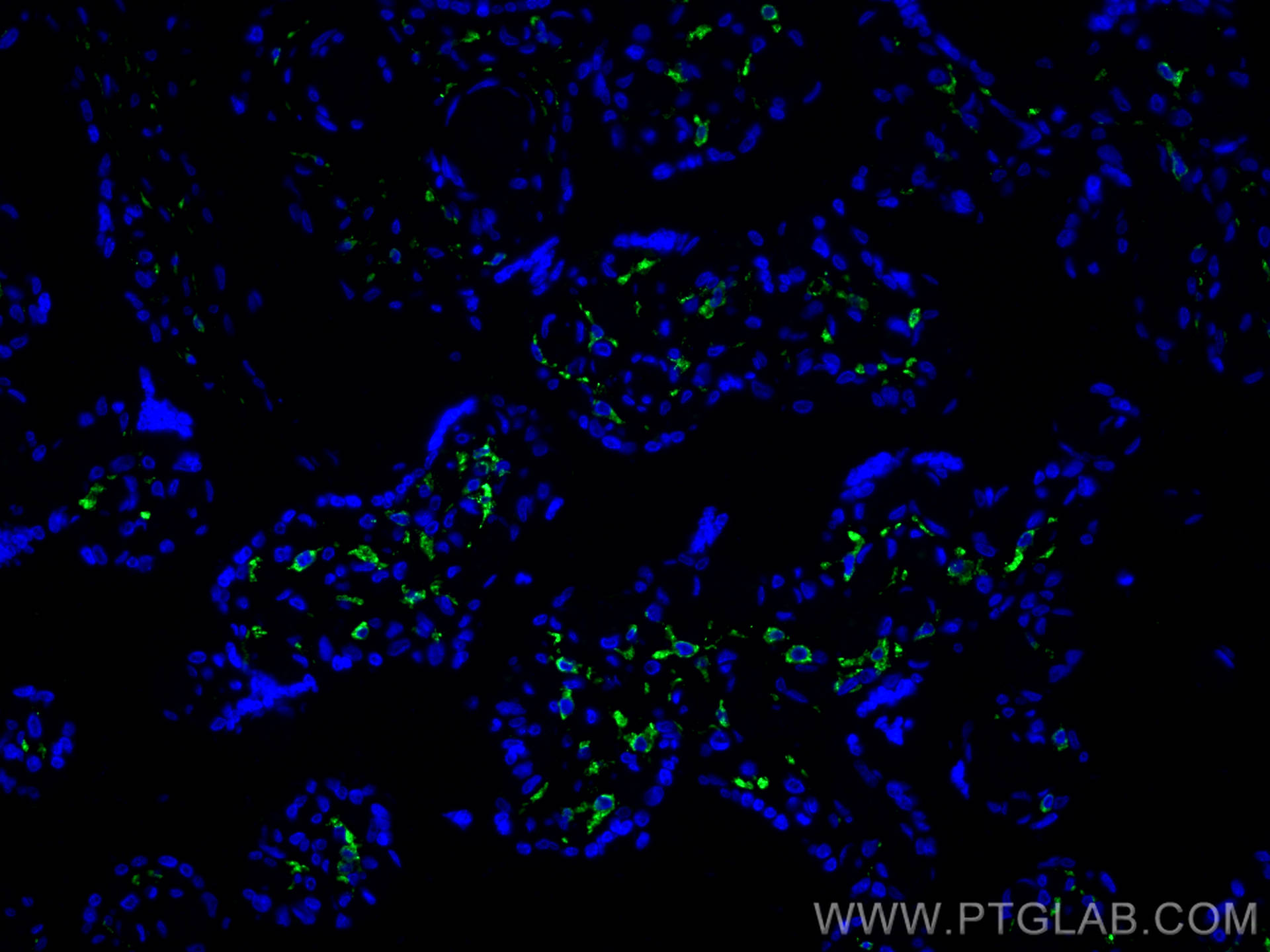 IF Staining of human placenta using 81525-1-RR