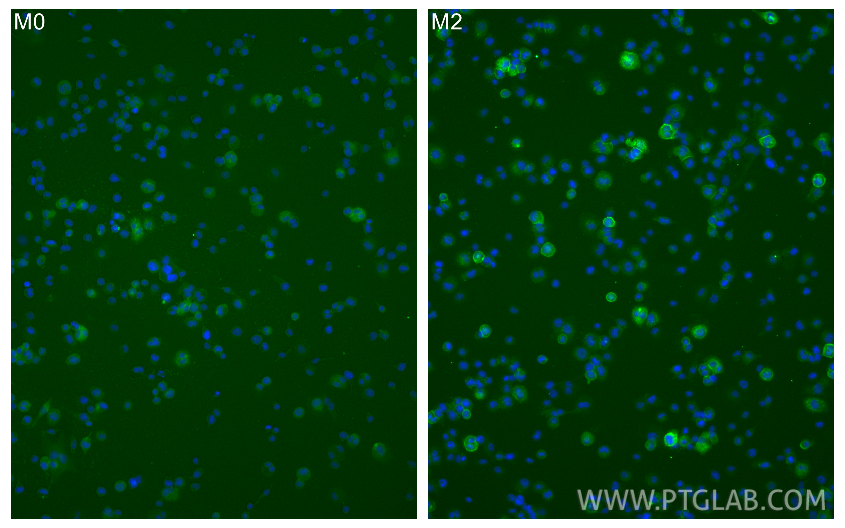 IF Staining of THP-1 using 81525-1-RR
