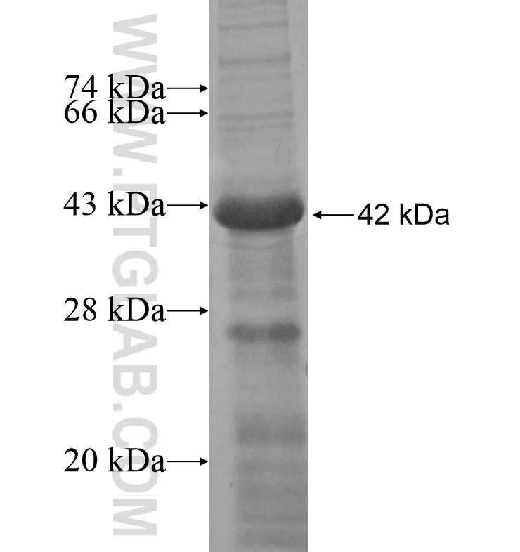 MRC2 fusion protein Ag16621 SDS-PAGE MRC2 fusion protein Ag16621 SDS-PAGE