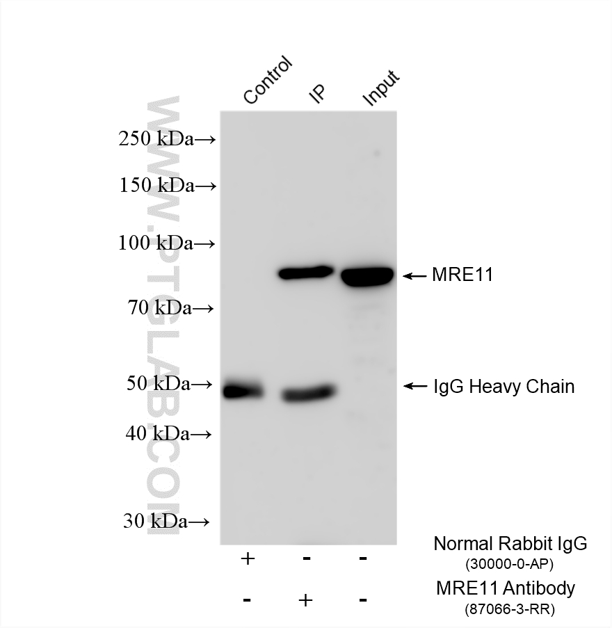 IP experiment of HeLa using 87066-3-RR