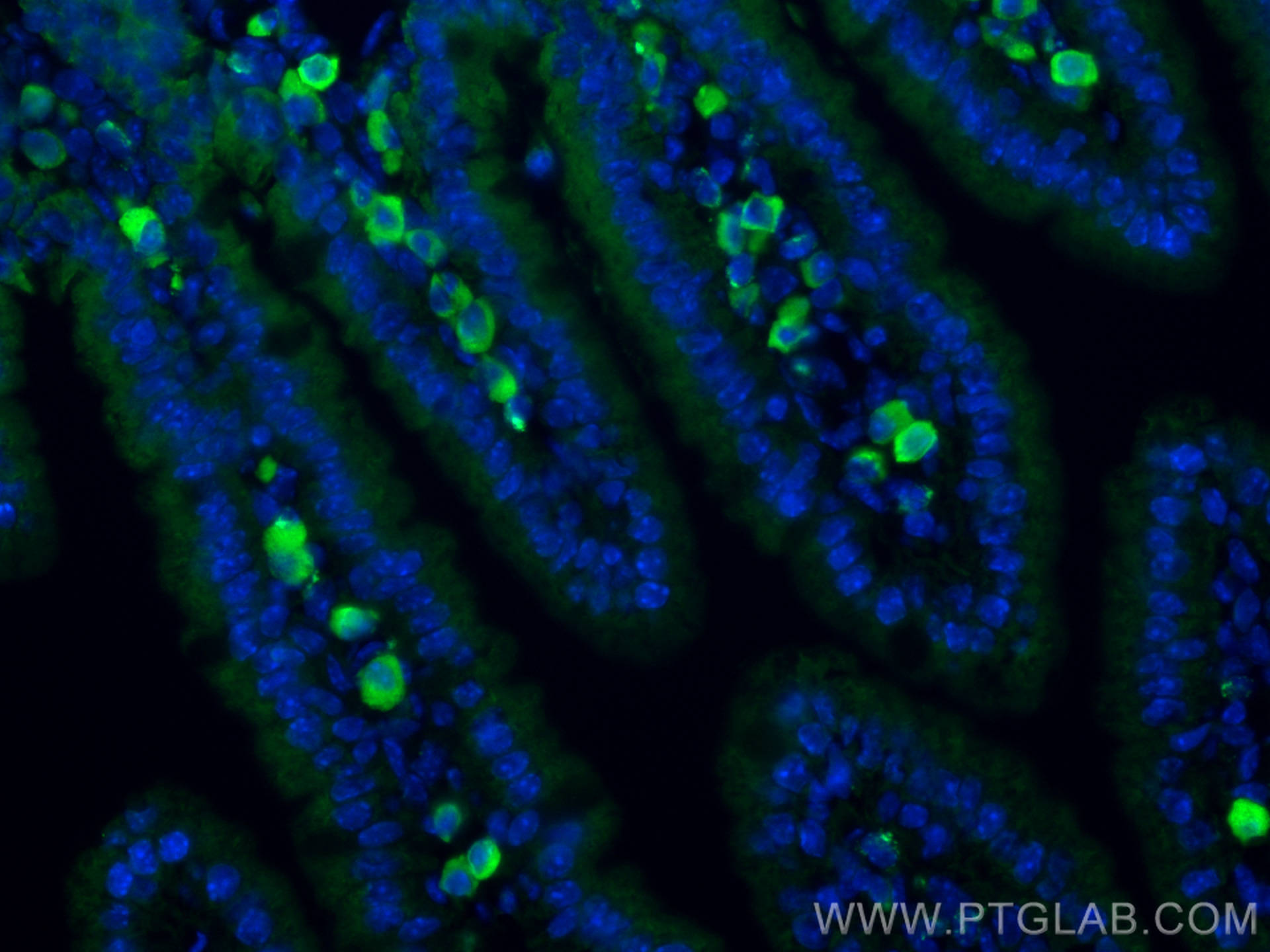 IF Staining of mouse small intestine using 23640-1-AP
