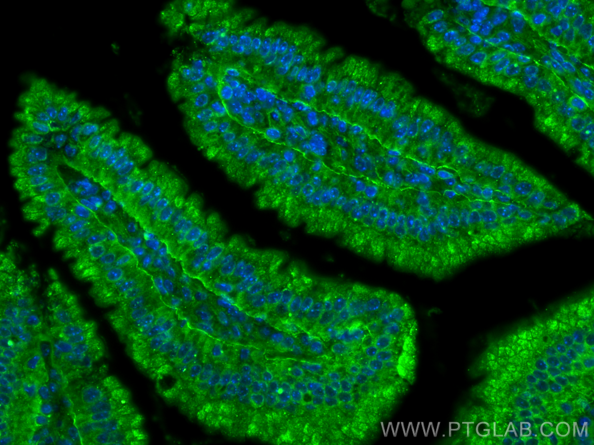 Immunofluorescent analysis of (4% PFA) fixed paraffin-embedded mouse small intestine tissue using MRGPRD antibody (23640-1-AP) at dilution of 1:200 and CoraLite®488-Conjugated Goat Anti-Rabbit IgG(H+L) (<a class='green' href='/productredirect?CatalogNo=SA00013-2' target='_blank'>SA00013-2</a>). Heat mediated antigen retrieval with Tris-EDTA buffer (pH 9.0). IF Staining of mouse small intestine using 23640-1-AP