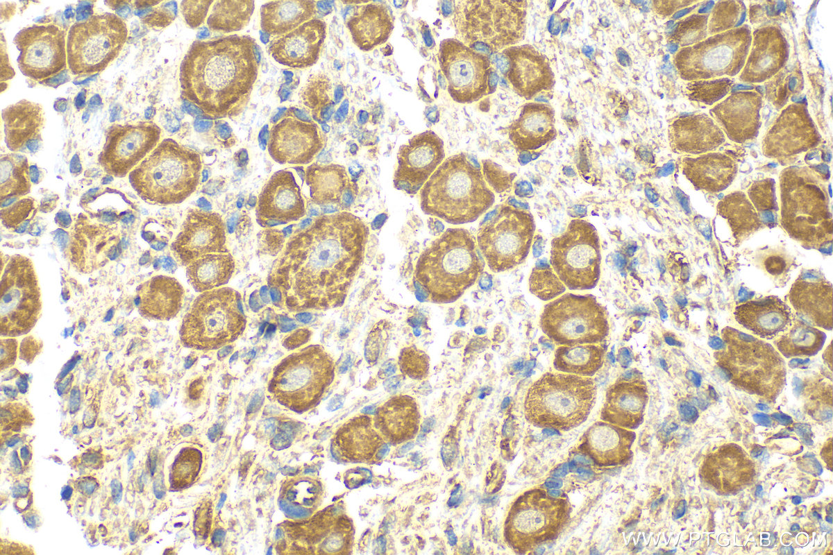 IHC staining of rat dorsal root ganglion using 23640-1-AP