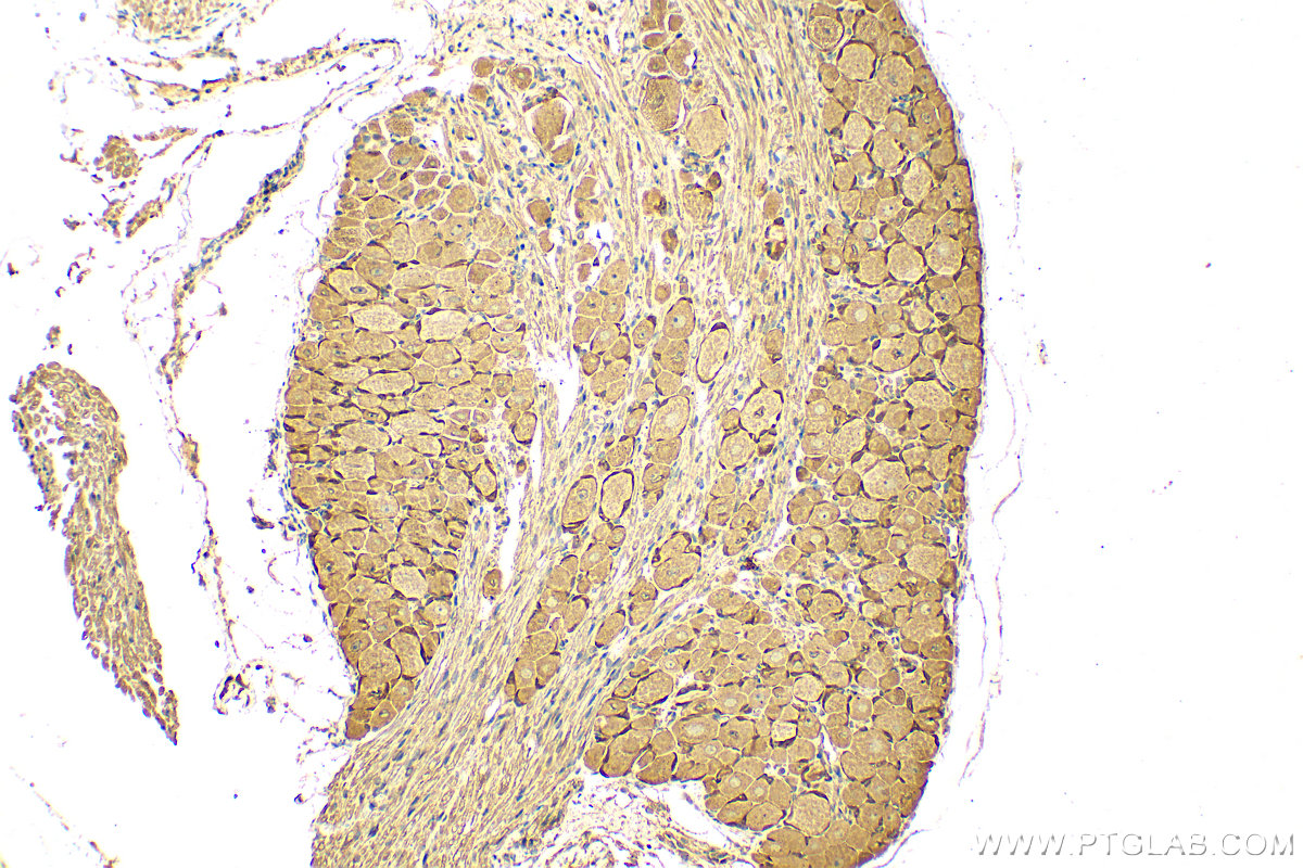 IHC staining of rat dorsal root ganglion using 28080-1-AP