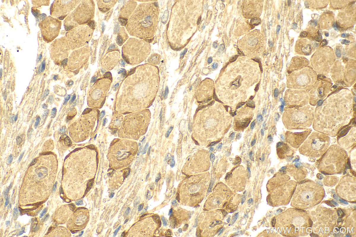 IHC staining of rat dorsal root ganglion using 28080-1-AP