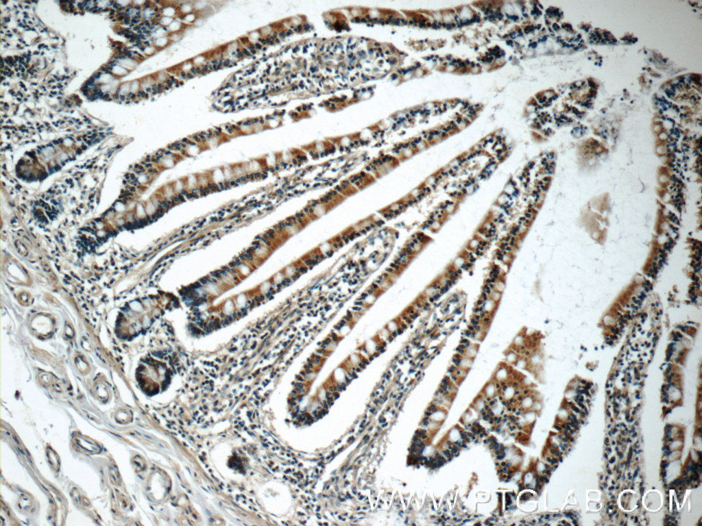 IHC staining of human small intestine using 24893-1-AP