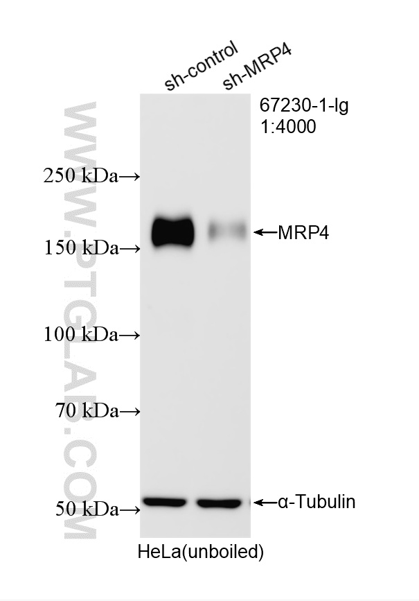 WB analysis of HeLa using 67230-1-Ig