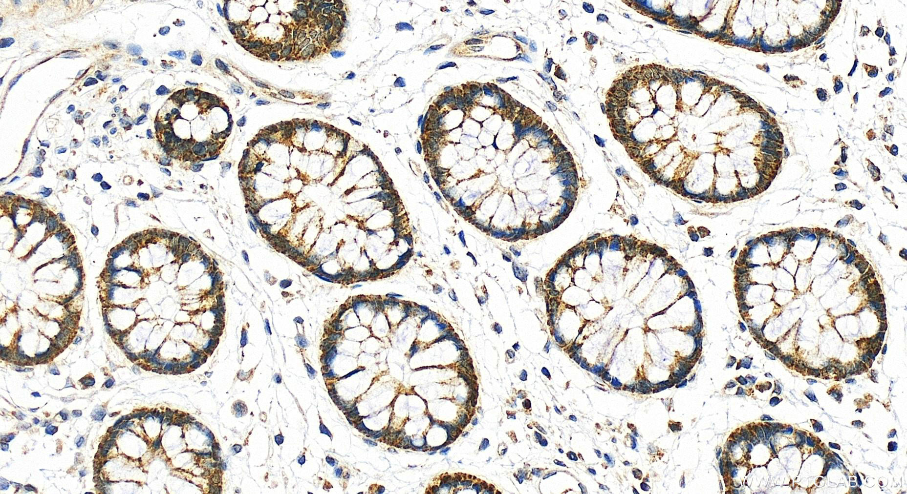IHC staining of human colon using 21617-1-AP