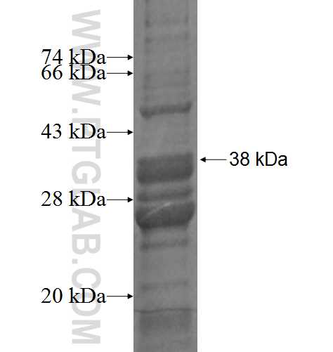 MRP63 fusion protein Ag7289 SDS-PAGE MRP63 fusion protein Ag7289 SDS-PAGE