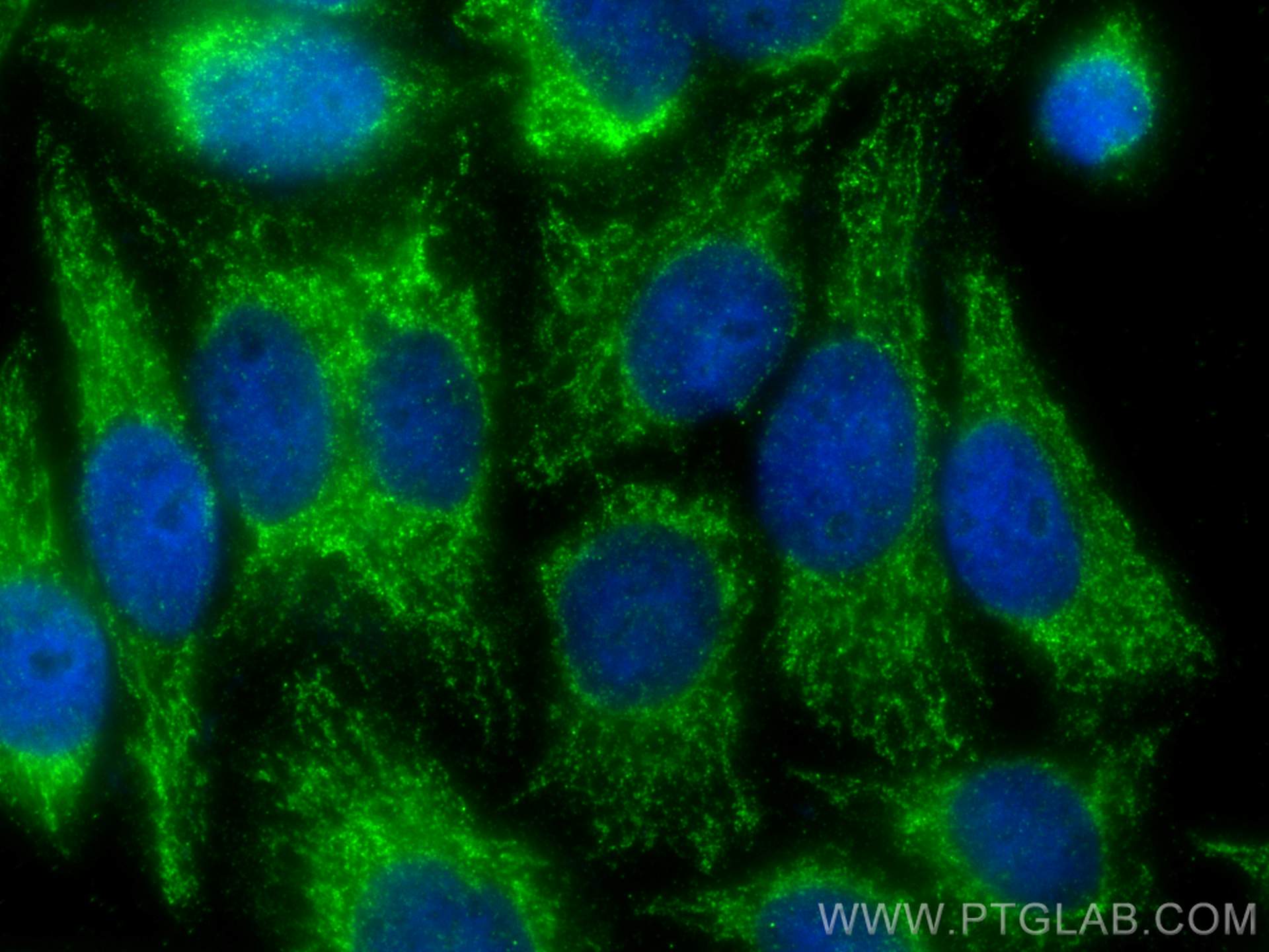 IF Staining of HepG2 using 16652-1-AP