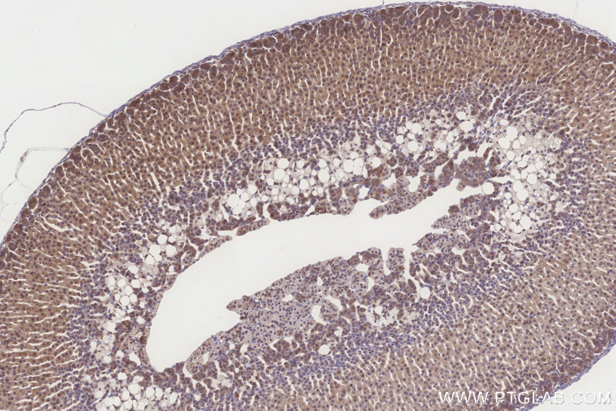 IHC staining of mouse adrenal gland using 16652-1-AP IHC staining of mouse adrenal gland using 16652-1-AP