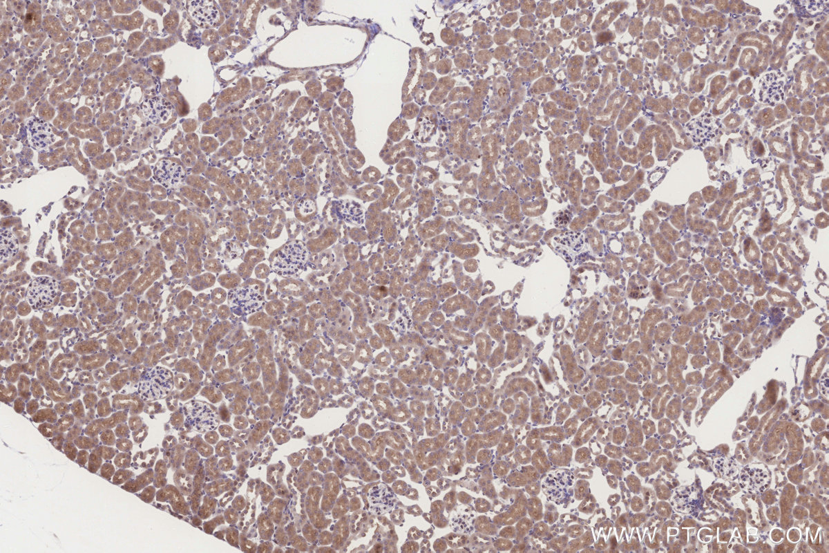 IHC staining of mouse kidney using 16652-1-AP IHC staining of mouse kidney using 16652-1-AP