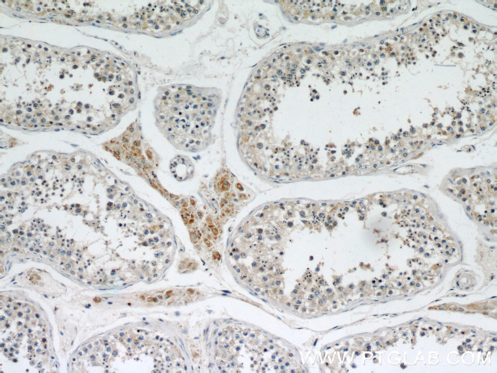 IHC staining of human testis using 16652-1-AP