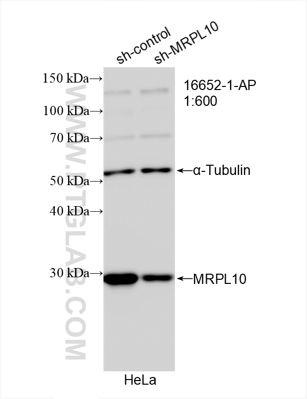 WB analysis of HeLa using 16652-1-AP